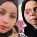 রাফাহ সীমান্তের পরীক্ষামূলক পুনরায় খোলা নিয়ে অনিশ্চয়তায় গাজার রোগীরা
