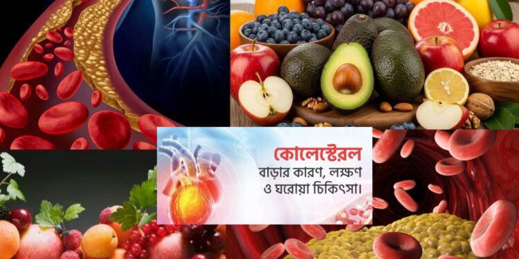 কোলেস্টেরল নিয়ন্ত্রণ: হৃদরোগ ও স্ট্রোকের ঝুঁকি কমাতে জরুরি কিছু টিপস