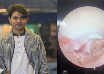 শাহবাগে ছাত্রদলের হামলার শিকার জুলহাসের কানের পর্দা ফেটে গেছে