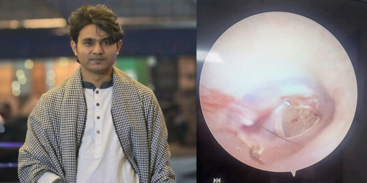 শাহবাগে ছাত্রদলের হামলার শিকার জুলহাসের কানের পর্দা ফেটে গেছে