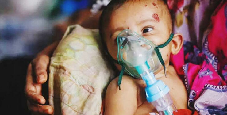 হাম উপসর্গে আরও ১১ শিশুর মৃত্যু