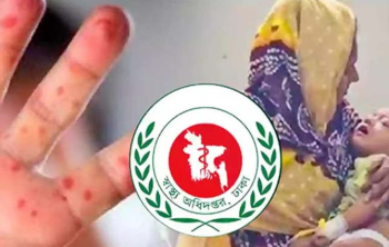 হাম ও উপসর্গে আরও ৭ শিশুর মৃত্যু, মোট প্রাণহানি ৪৩৯